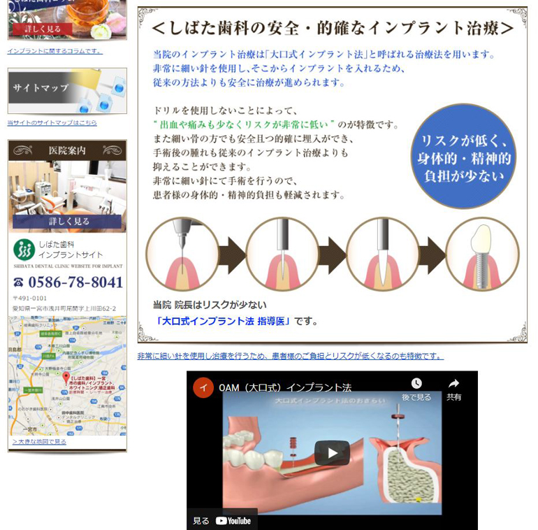 shibata-implant-website-introduce3.jpg
